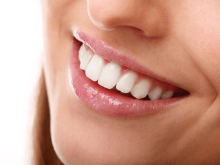 Особенности установки пломб на передние зубы